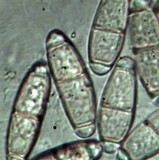 Calostilbella calostilbe image