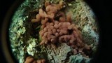 Arcyria denudata image