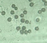 Scleroderma areolatum image