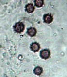 Scleroderma areolatum image