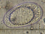 Ochrolechia szatalaensis image