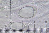 Ochrolechia africana image