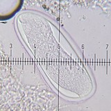Pertusaria multipunctoides image