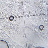 Pertusaria multipunctoides image