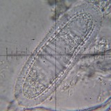 Pertusaria xanthodes image