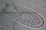 Pertusaria xanthodes image