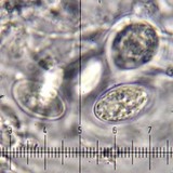Pertusaria subambigens image