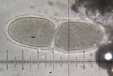 Varicellaria rhodocarpa image