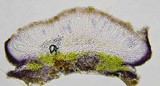 Caloplaca diphyodes image