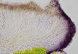 Caloplaca diphyodes image