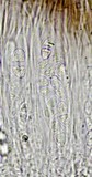 Caloplaca diphyodes image