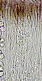 Caloplaca diphyodes image