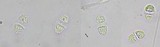 Caloplaca diphyodes image
