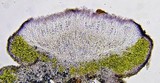 Caloplaca diphyodes image