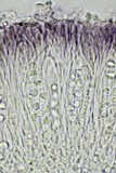 Caloplaca diphyodes image