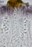 Caloplaca diphyodes image