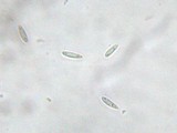Hymenoscyphus fructigenus image