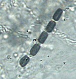 Hypoxylon rectangulosporum image