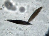 Rosellinia necatrix image
