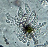 Nitschkia acanthostroma image