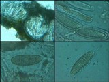 Pertusaria heterochroa image