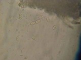 Peniophora aurantiaca image
