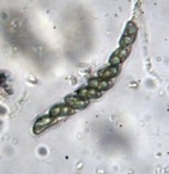 Kretzschmariella culmorum image