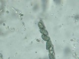 Kretzschmariella culmorum image