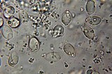 Xerula megalospora image