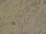 Exidia truncata image
