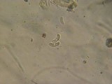 Exidia truncata image