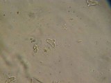 Exidia truncata image