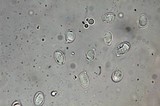 Amanita yema image