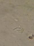 Dacrymyces capitatus image