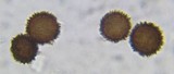 Scleroderma areolatum image