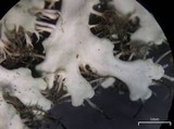 Heterodermia speciosa image