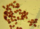 Rhodocollybia butyracea f. butyracea image
