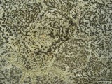 Porpidia albocaerulescens var. albocaerulescens image