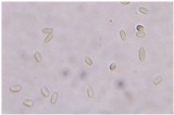Pilobolus umbonatus image