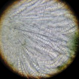 Patellaria atrata image