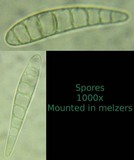 Patellaria atrata image