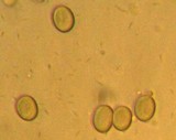 Mycena rubromarginata image
