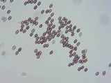 Psathyrella longistriata image