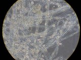 Mucor racemosus f. racemosus image