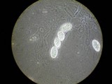 Gelasinospora brevispora image