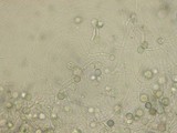 Image of Humicola lanuginosa