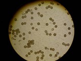Tilletia caries image