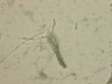 Penicillium roqueforti image