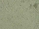 Penicillium roqueforti image