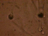 Aspergillus fumigatus image